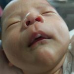 赤ちゃんの上唇の水膨れは何?薬は必要?病院で聞いてみた